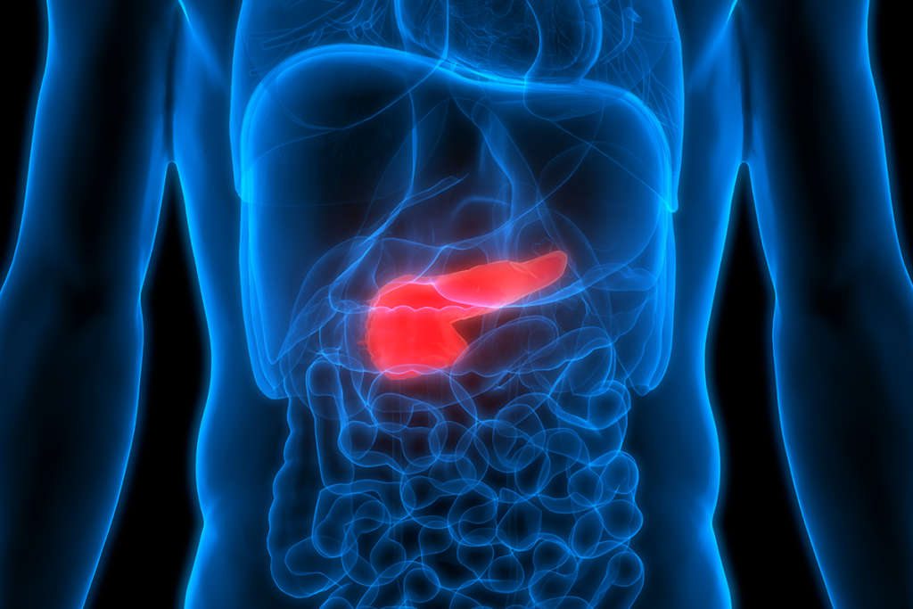 Pancreatic Cancer Black Men's Health